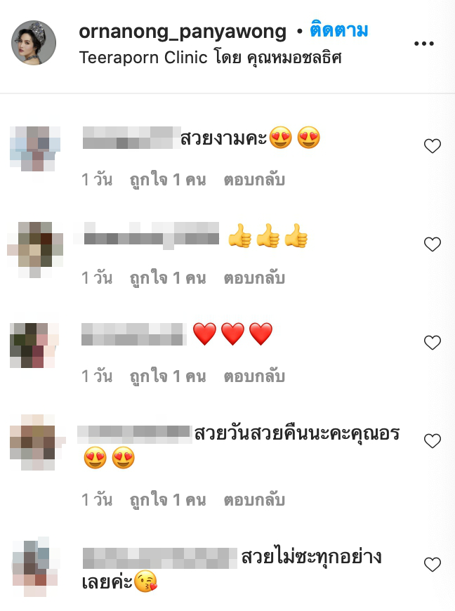 อรอนงค์ อัดคลิปยอมรับ ซุ่มเงียบศัลยกรรมตา2ชั้น จนสวยเช้ง