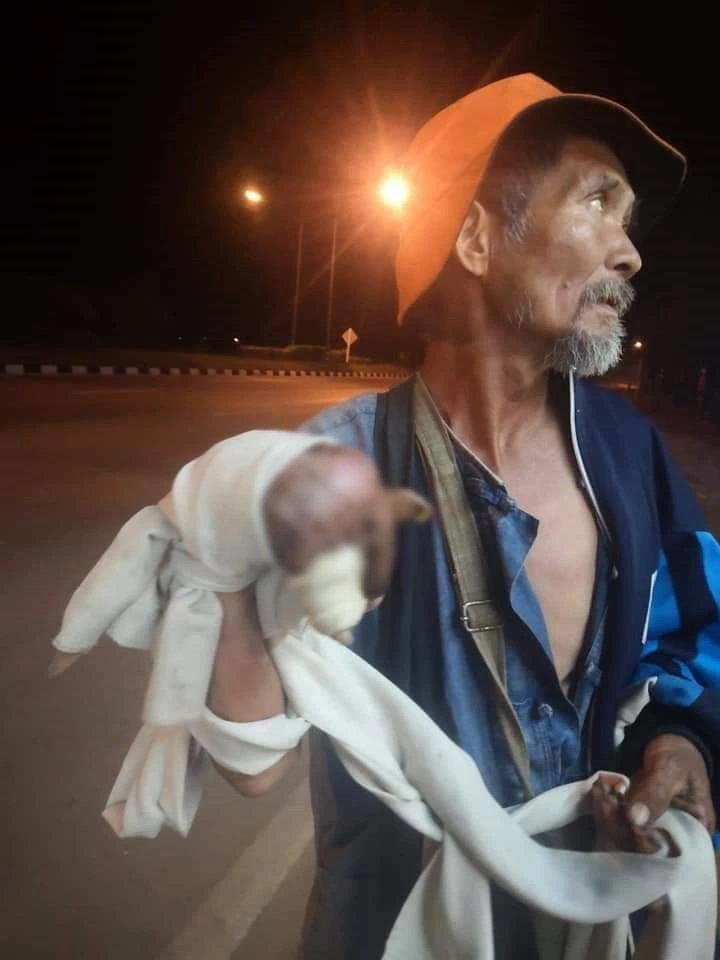 คุณลุงมือขวาใหญ่โตผิดปกติ สุดเจ็บป่วยทรมาน ไร้เงินรักษาร่างกาย