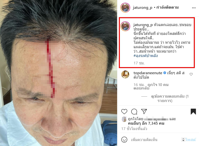 โน้ต เชิญยิ้ม โผล่คอมเมนต์แรง จตุรงค์ หลังชนขอบประตูจนหัวแตก