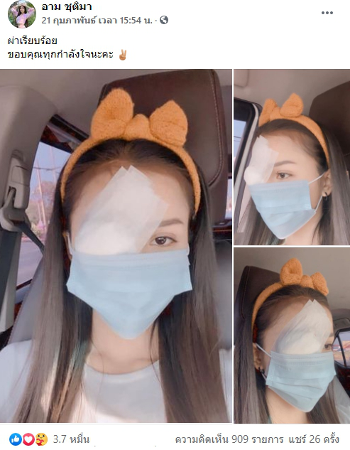 ชาวเน็ตเป็นห่วง อาม ชุติมา หลังโพสต์รูปปิดตาข้างหนึ่ง
