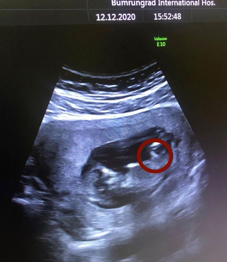 แมน การิน สุดภูมิใจ เผยภาพลูกชายครั้งแรก ให้เห็นกันแบบชัดๆ