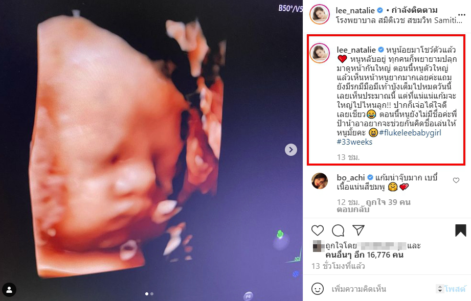 ลี นาตาลี อวดโฉมลูกสาว พร้อมชวนตั้งชื่อเล่น ก่อนใกล้คลอด