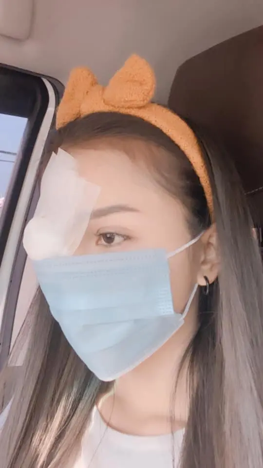 ชาวเน็ตเป็นห่วง อาม ชุติมา หลังโพสต์รูปปิดตาข้างหนึ่ง