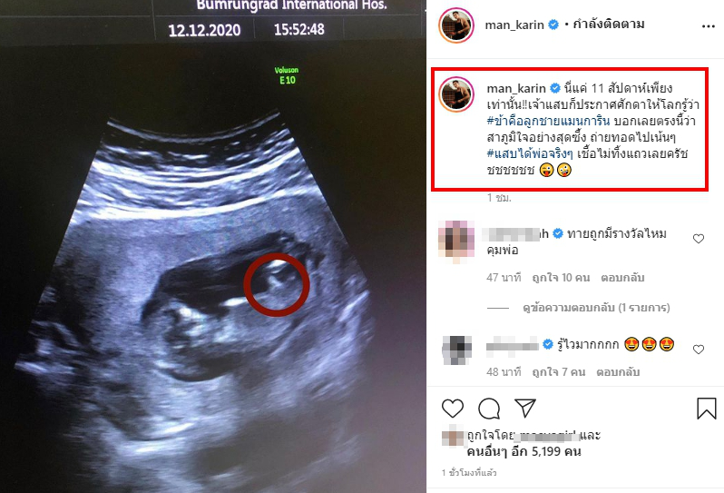 แมน การิน สุดภูมิใจ เผยภาพลูกชายครั้งแรก ให้เห็นกันแบบชัดๆ
