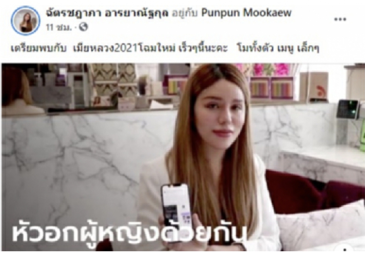 เจ้าของคลินิก เผยภาพล่าสุด เมียหลวงบุกงานแต่ง ได้ตัดไหมแล้ว หลังเข้าโครงการทำสวยให้ผัวเสียดาย ครบ 14 วัน บอกเลยว่าสวยเป๊ะทุกองศามาก ๆ เปลี่ยนไปเป็นคนละคนเลยทีเดียว