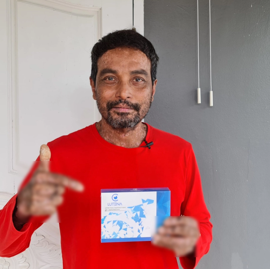 วินัย ไกรบุตร ยอมรับท้อแต่สู้เพื่อครอบครัว หลังตุ่มน้ำพองติดเชื้อรอบที่5