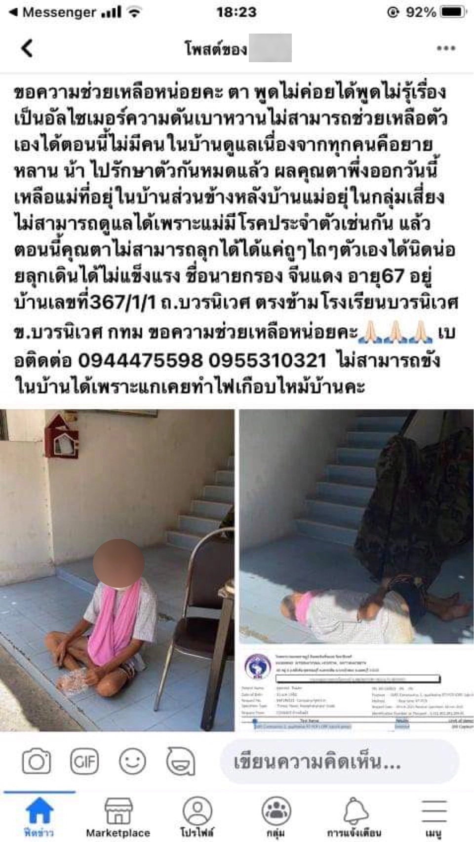 ตามีโรคประจำตัว เพิ่งรู้ผลป่วยโควิด ต้องอยู่ลำพัง ช่วยเหลือ​ตัวเองไม่ได้