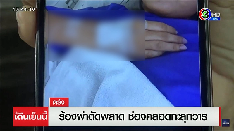 แม่ร้องทุกข์ หมอผ่าตัด ลูกสาววัย 25 พลาด 