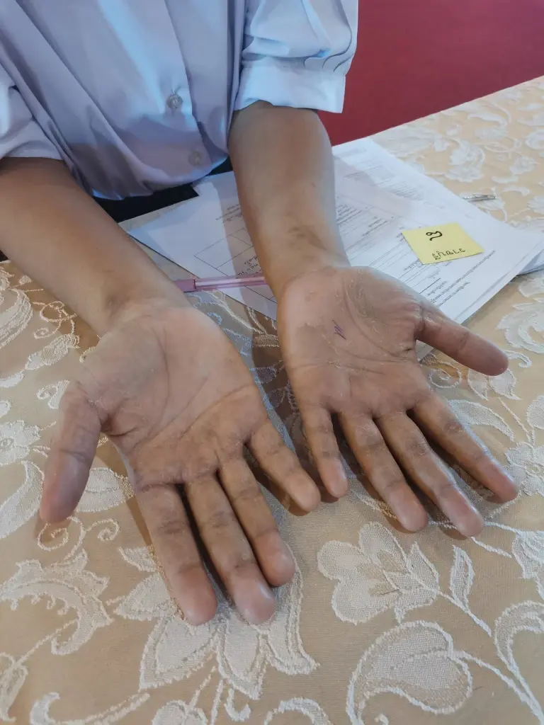 ครูพยาบาล เผยความประทับใจ หลังเห็นมือของนักเรียน ที่สอบสัมภาษณ์