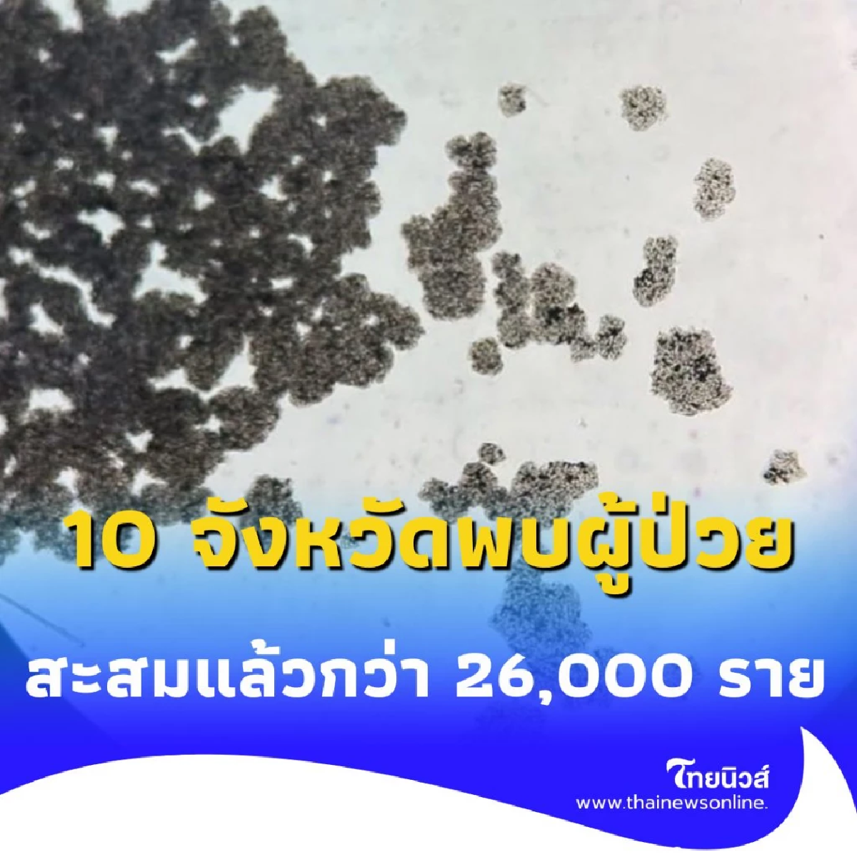10 จังหวัดผู้ป่วย HIV ทั่วประเทศสะสมแล้วกว่า 26,000 ราย