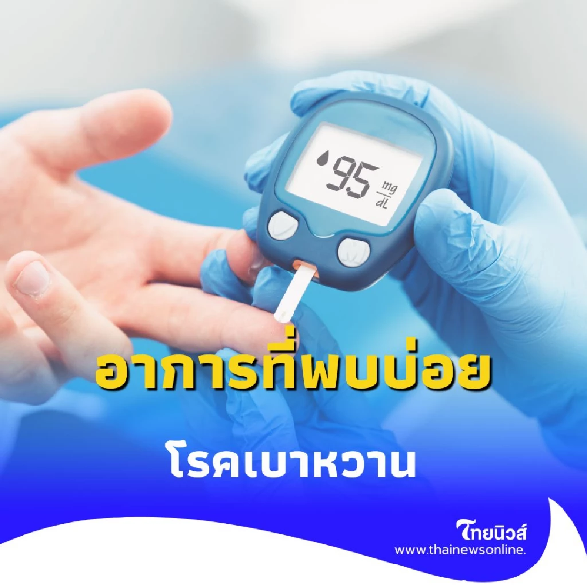อาการที่พบบ่อย 10 สัญญาณเตือน โรคเบาหวาน ที่คุณไม่ควรมองข้าม