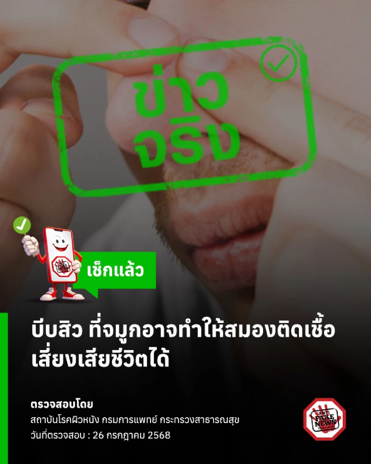 อันตรายกว่าที่คิด บีบสิวใน สามเหลี่ยมอันตราย เสี่ยงติดเชื้อในสมอง-เสียชีวิต