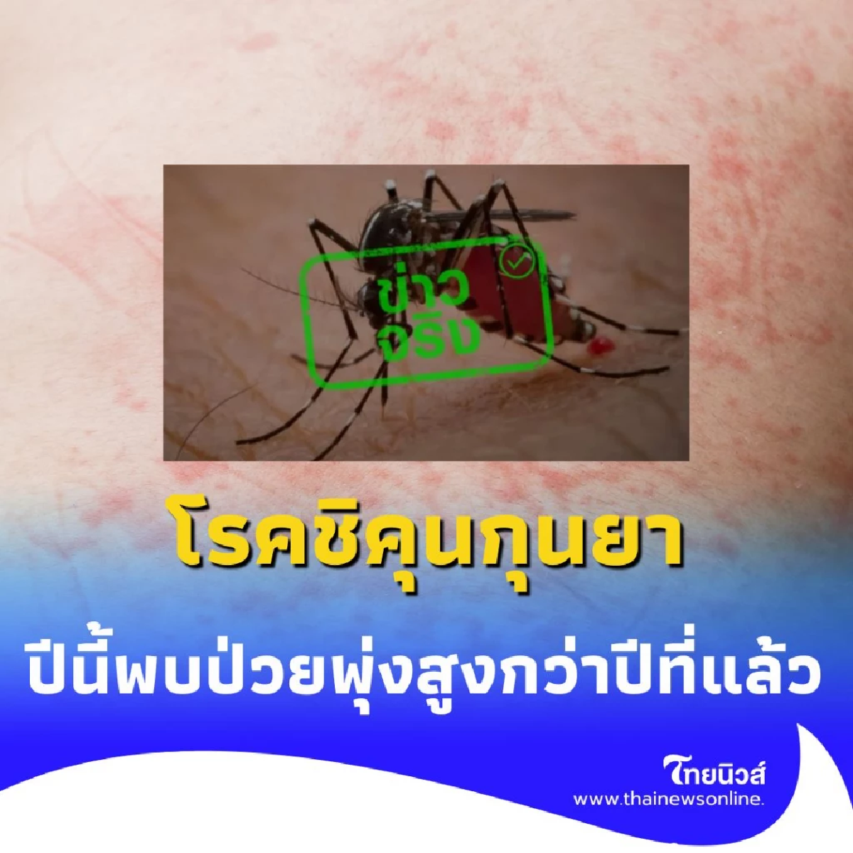 ยอดผู้ป่วย โรคชิคุนกุนยา ปีนี้พุ่งสูงกว่าปีที่แล้วหลายเท่าตัว