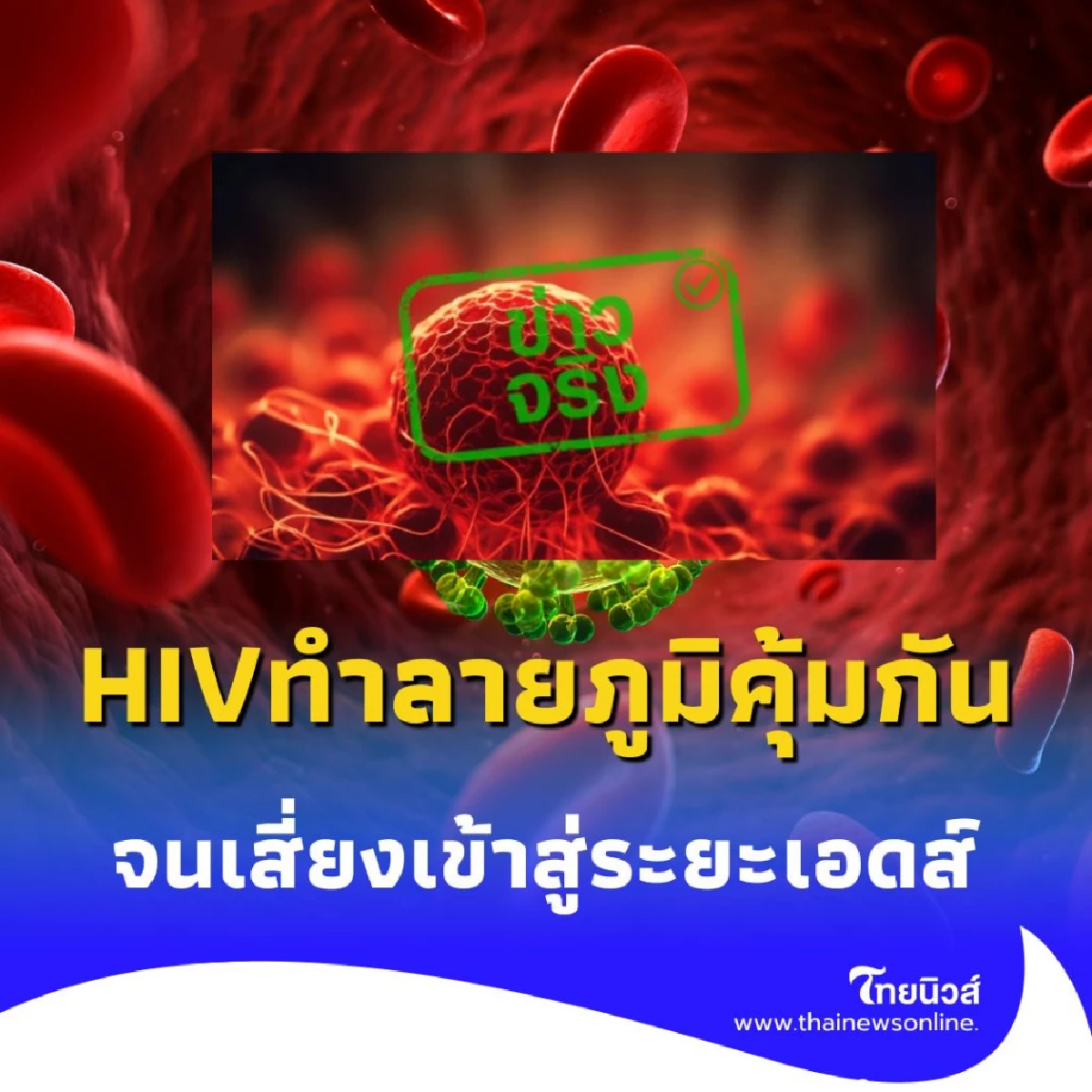 ทำไมต้องรีบรักษา HIV เปิดเหตุผลสำคัญที่เชื้อทำลายภูมิคุ้มกัน จนเสี่ยงเข้าสู่ระยะเอดส์