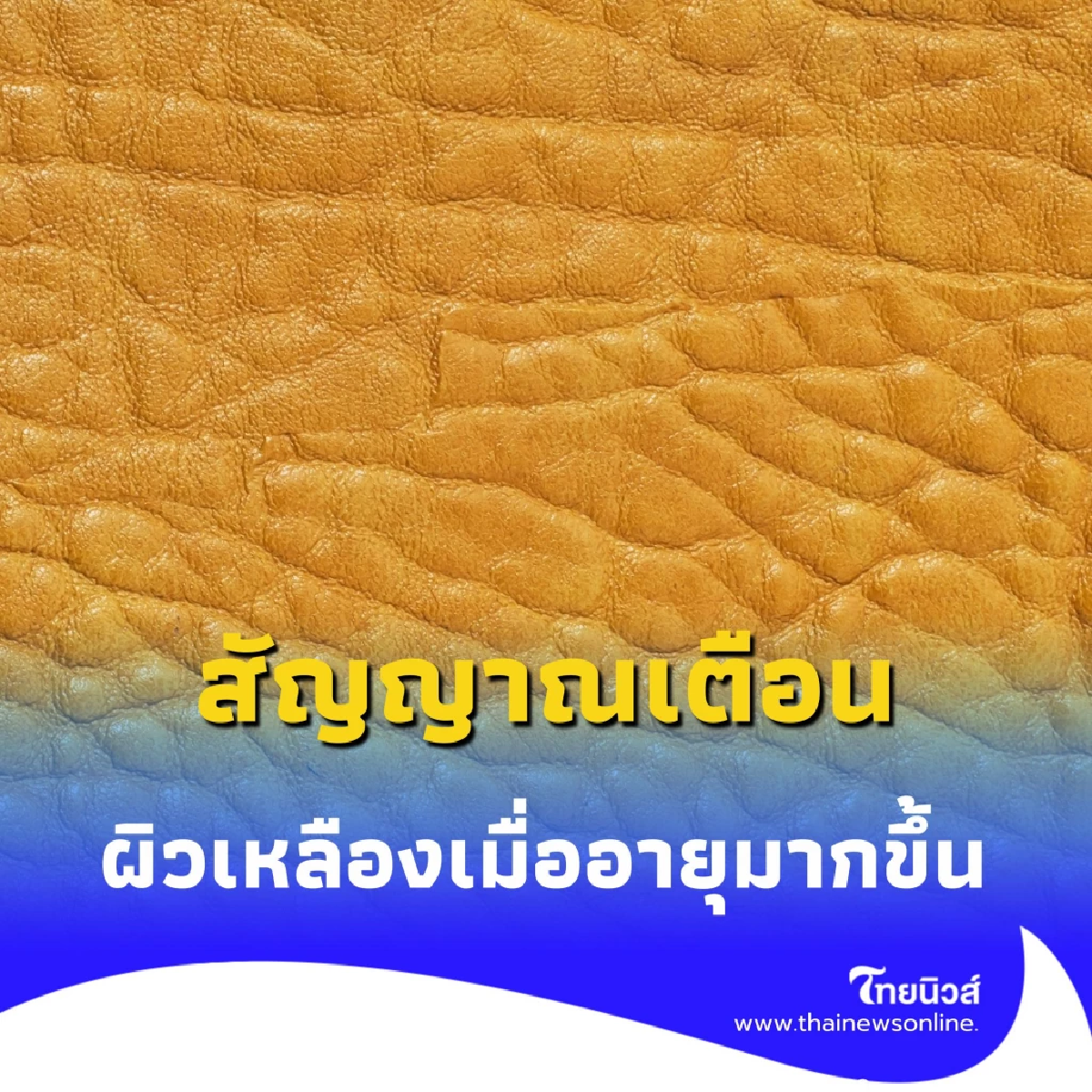 ผิวเหลืองเมื่ออายุมาก ไม่ใช่แค่เรื่องผิว แต่คือสัญญาณจากภายใน