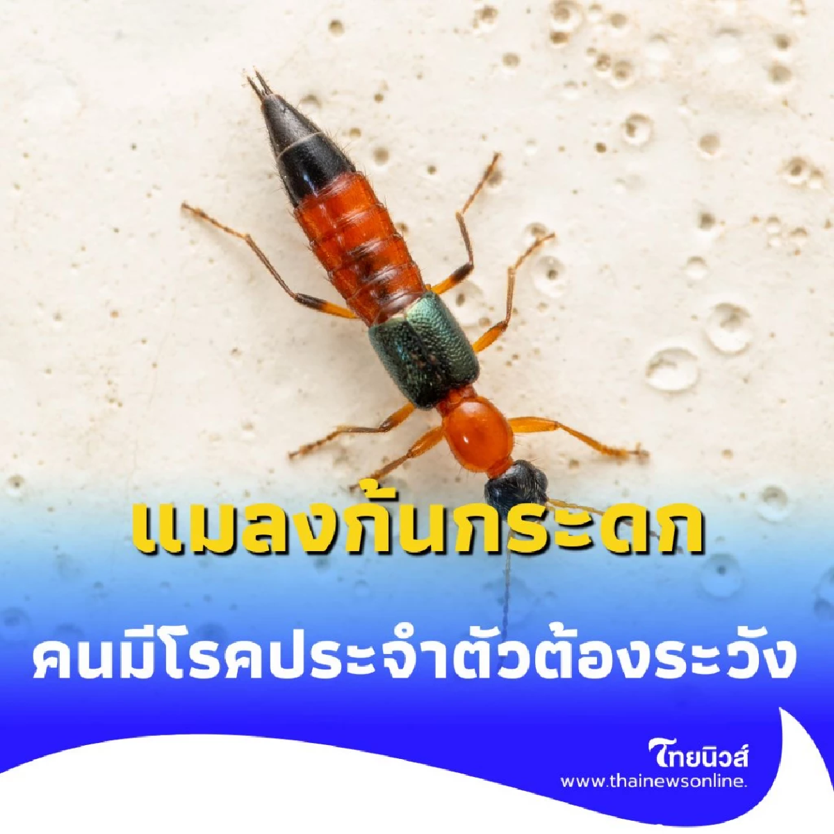 พิษแมลงก้นกระดกไม่ได้แค่คัน แต่มันคือภัยร้ายแรงที่คร่าชีวิต