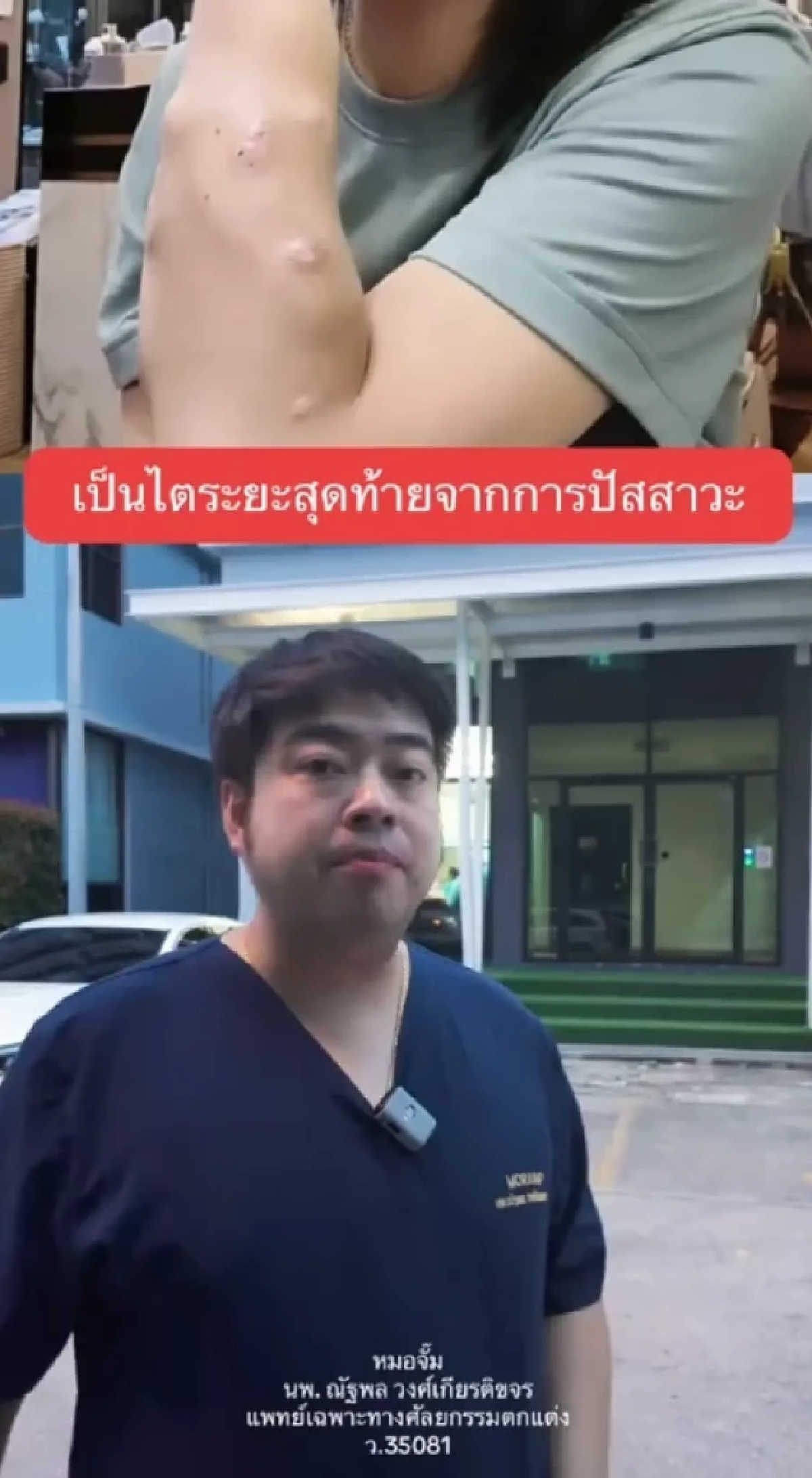 เตือนสาวๆ \"หมอดัง\" เปิดชัด 4 พฤติกรรมเสี่ยง โรคไตวายระยะสุดท้าย