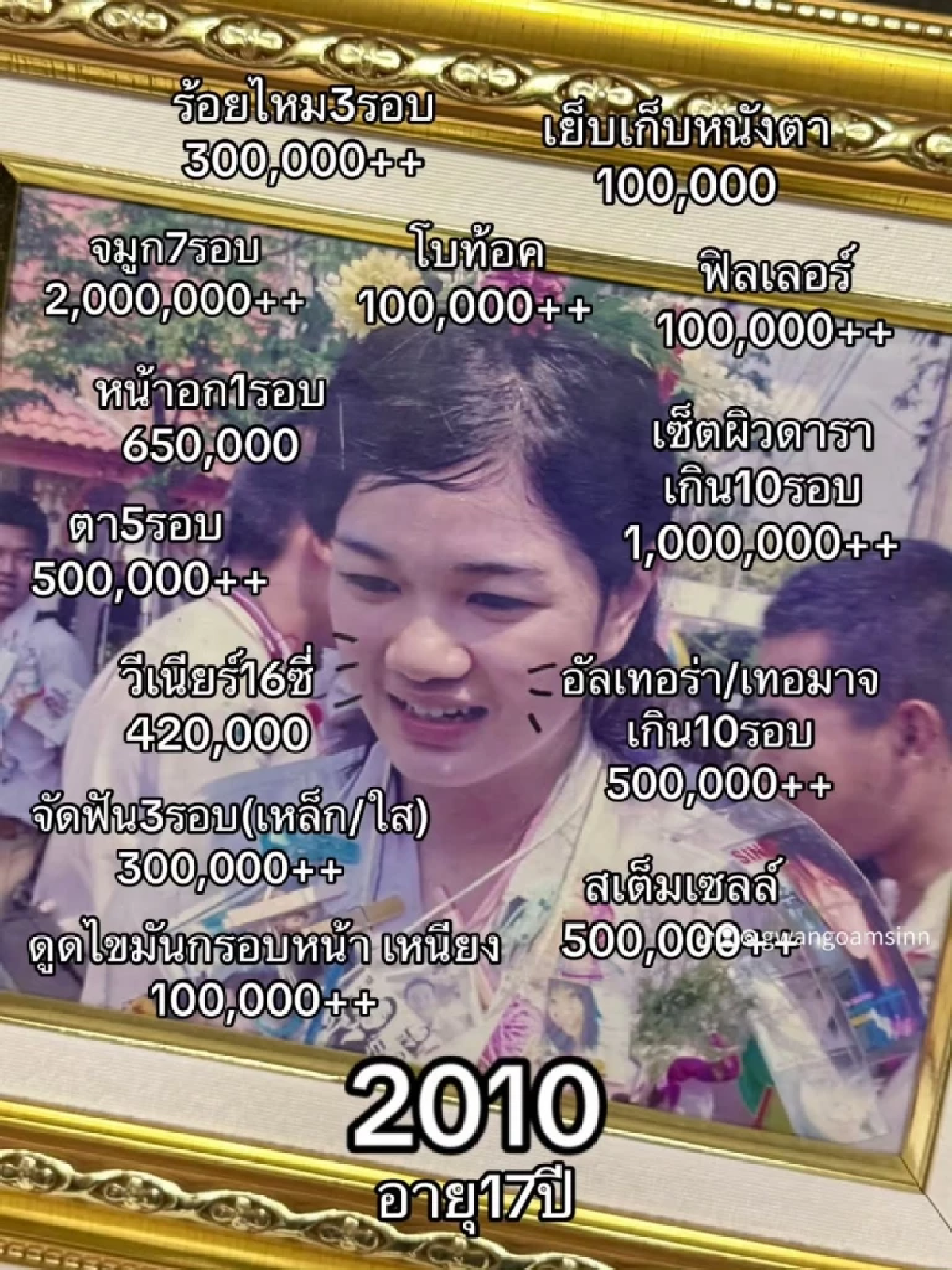กวาง เผยหมดเปลือก 16 ปี แห่งการลงทุน ทำศัลยกรรมอะไรบ้าง คุ้มไหม