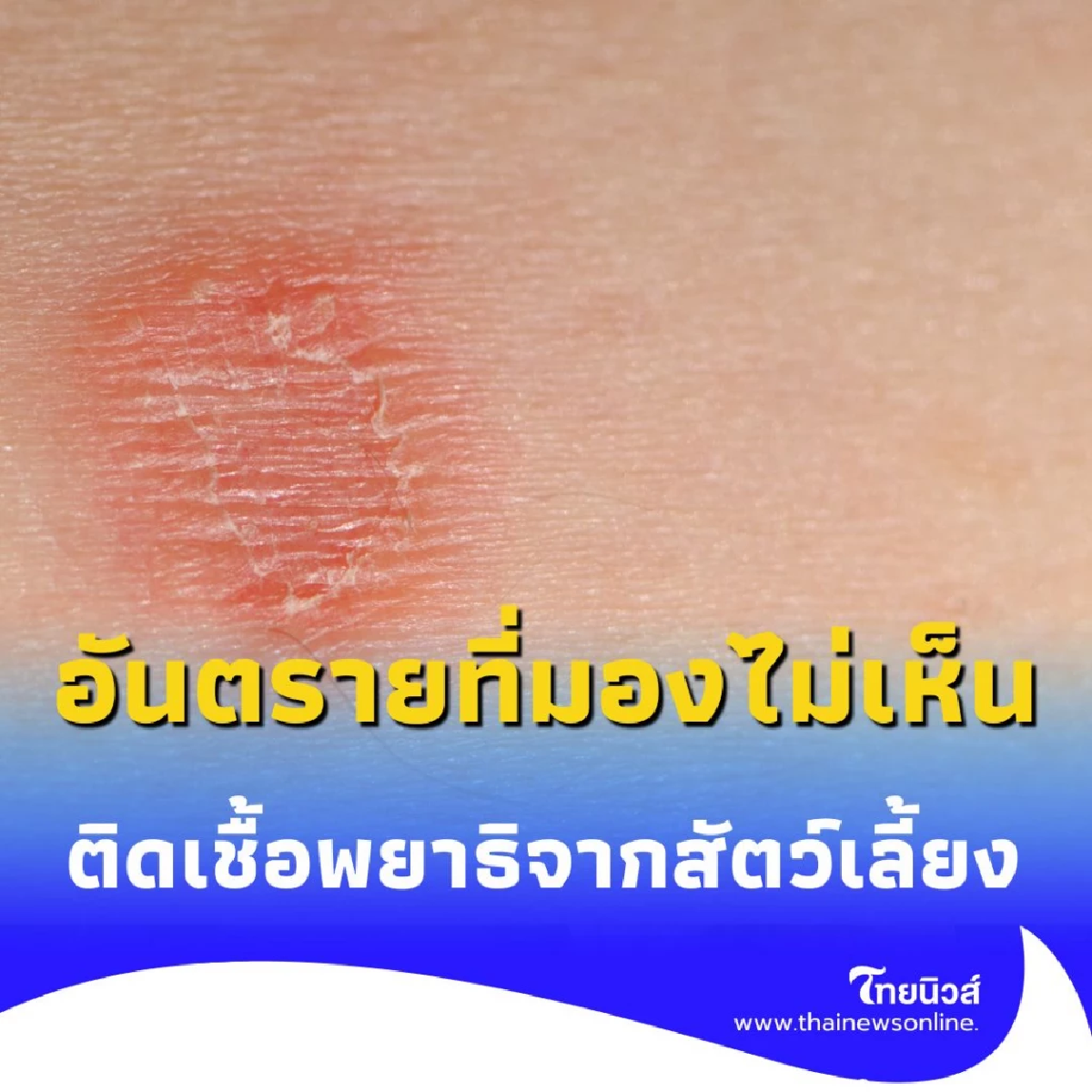 เดินเท้าเปล่าบนดิน เสี่ยงติดเชื้อพยาธิจากสัตว์เลี้ยง