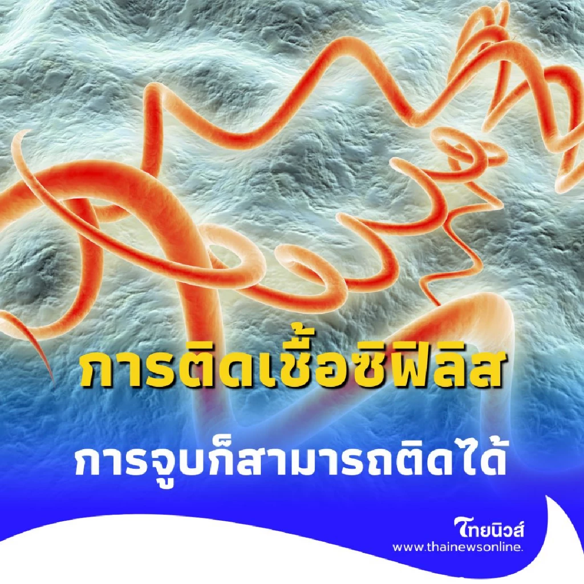 อย่าประมาท เปิดเส้นทางการติดเชื้อ ซิฟิลิส ทางใหม่ผ่านการจูบ