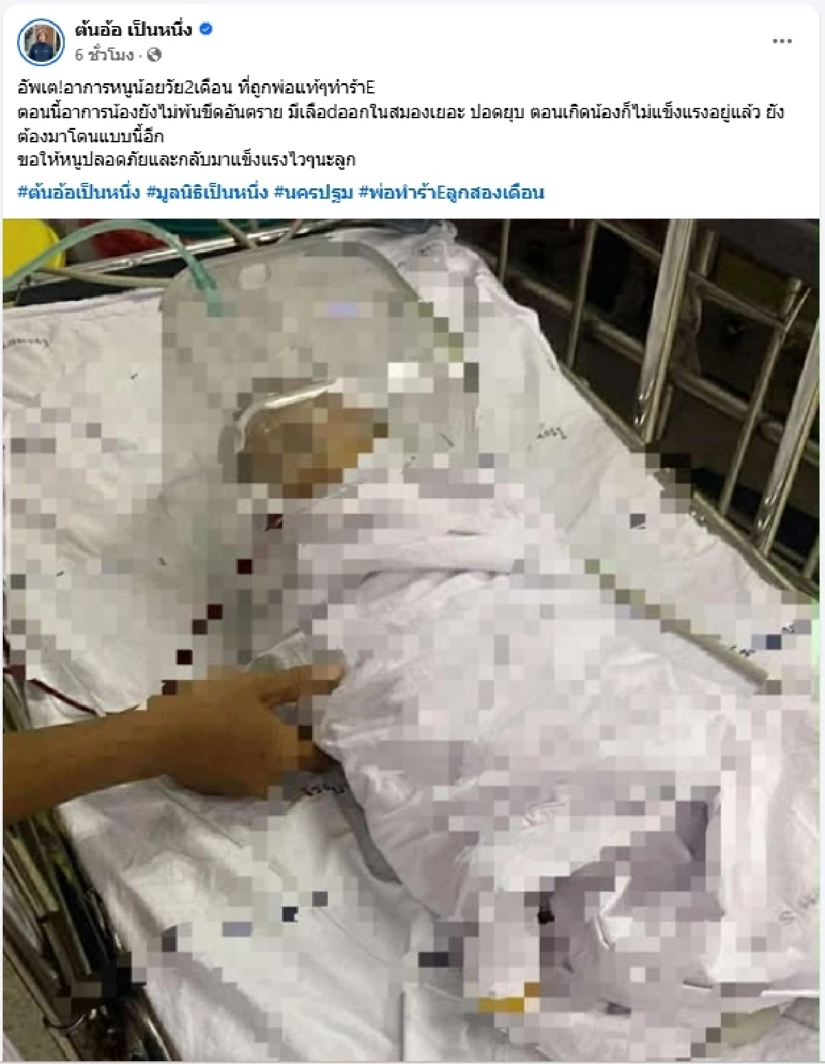 น่าห่วงมาก อาการล่าสุดหนูน้อย 2 เดือน ถูกพ่อโหดทำร้ายประชดเมีย