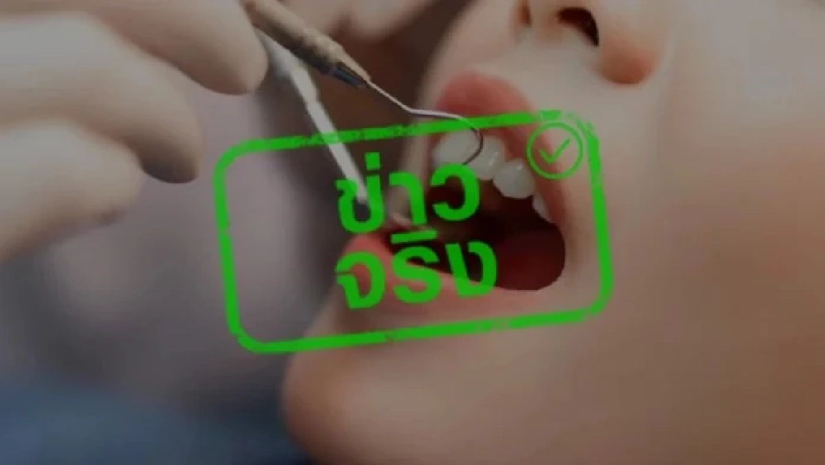 ประกันสังคม เพิ่มสิทธิทำฟันปลอม ผ่าฟันคุด มีรายละเอียดเพิ่มเติม