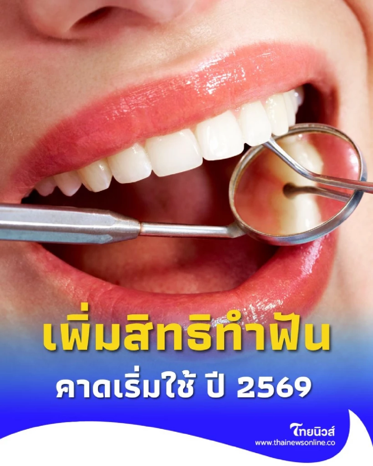 ข่าวดีจากประกันสังคม ผู้ประกันตนเฮ เพิ่มสิทธิทำฟัน เข้าถึงการรักษาได้ง่ายขึ้น