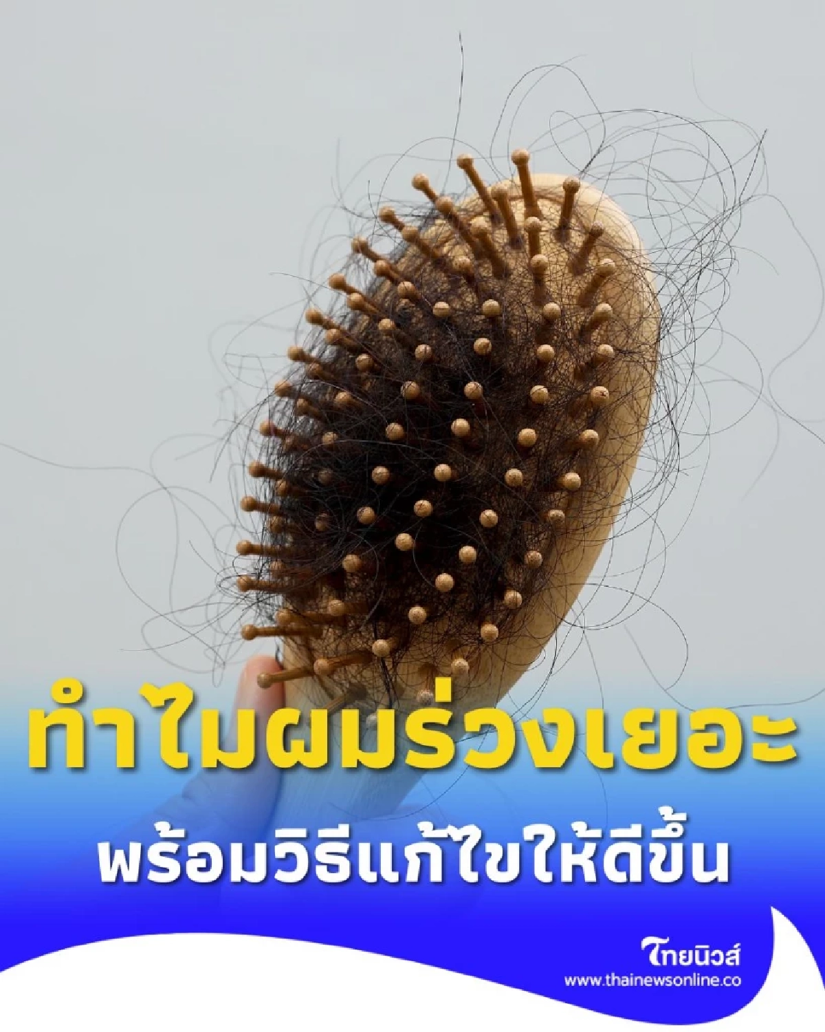 ทำไมผมร่วงเยอะจัง เปิดสาเหตุ พร้อมวิธีแก้ไขให้ดีขึ้น