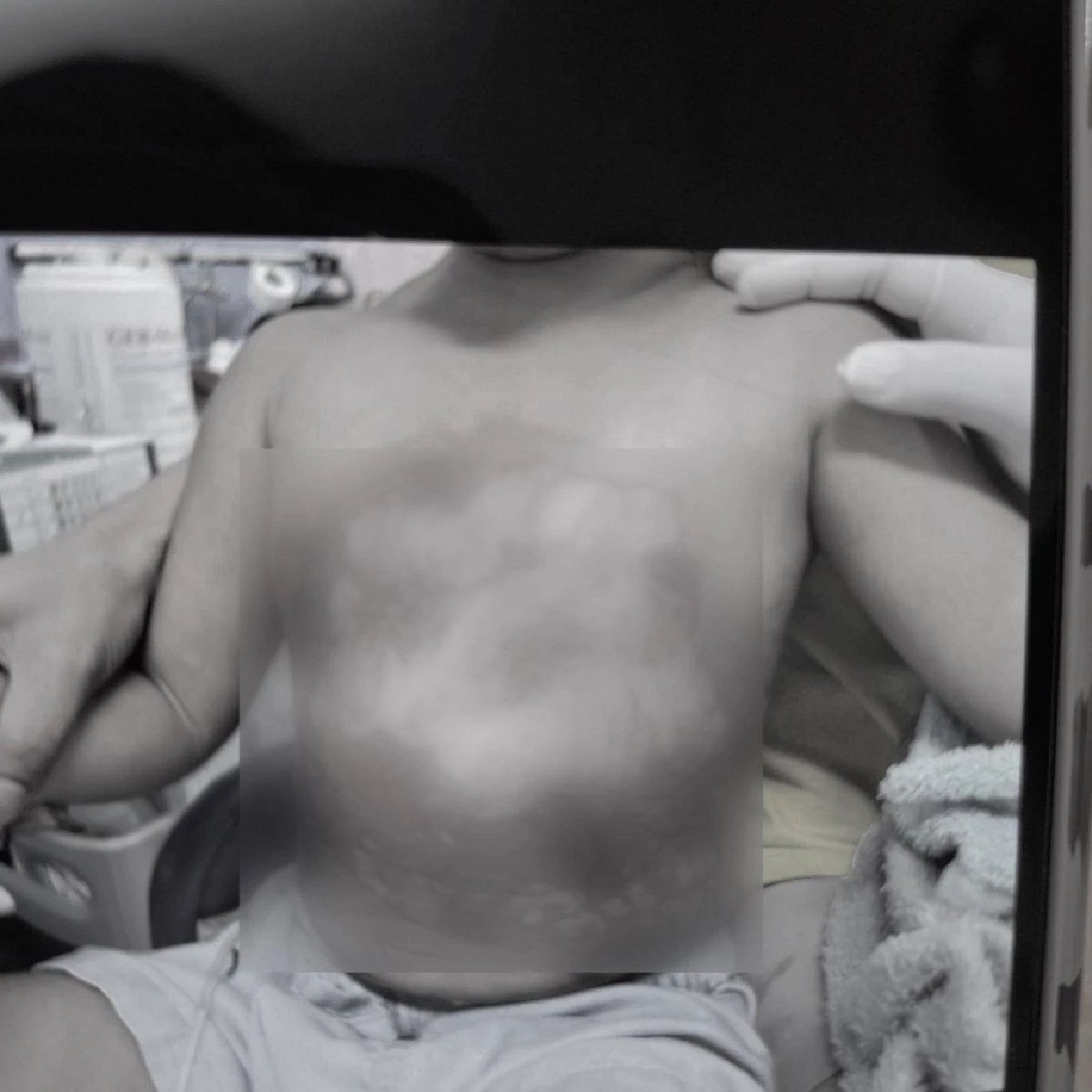 แพทยสภา รับเรื่องคลินิกราดน้ำร้อนใส่เด็ก 3 ขวบ สั่งปิดชั่วคราว รอผลตรวจสอบ