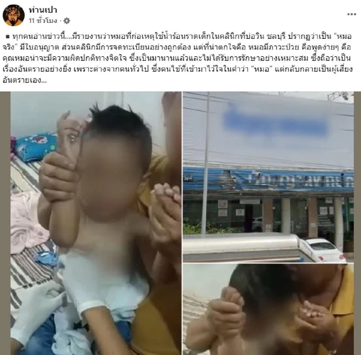 อัพเดตล่าสุดอาการ หนูน้อย 3 ขวบ โดน หมอคลินิกดัง รักษาแบบแปลกๆ