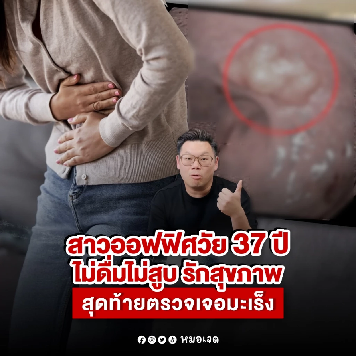 รู้สาเหตุยิ่งตกใจ สาววัย 37 ออกกำลังกาย กินคลีน ตรวจเจอะเร็งลำไส้
