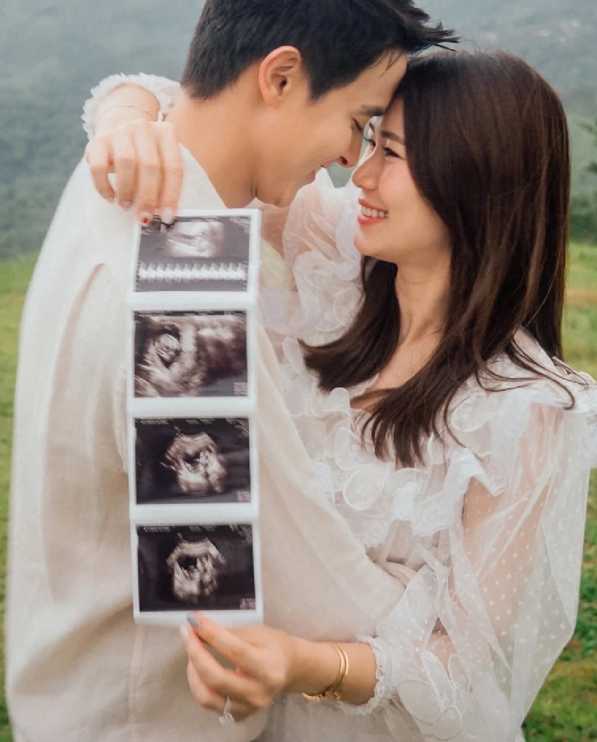 เจมส์ จิรายุ อวดโมเมนต์ โพสต์อัลตราซาวด์ 4 มิติ ลูกชายคนแรก