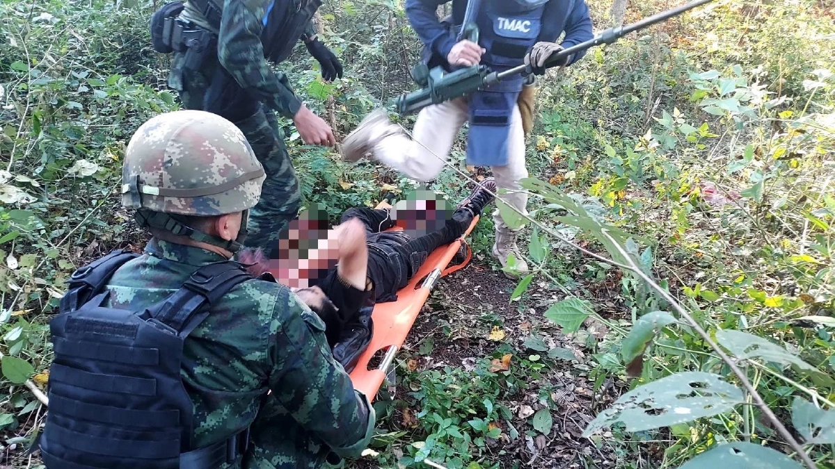 ทบ. ชี้เหตุชายจีนเหยียบระเบิด สะท้อนปัญหาทุ่นระเบิดชายแดน