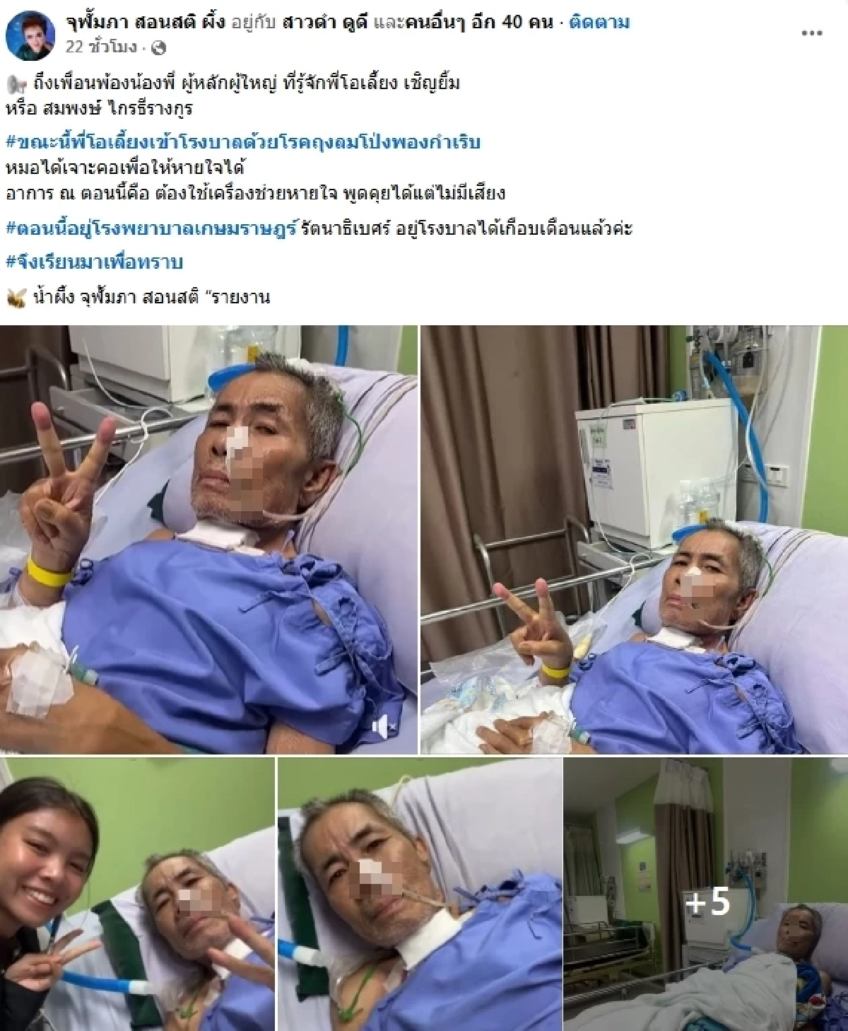 เผยอาการล่าสุด \"ตลกดัง\" ป่วยหนัก ต้องใช้เครื่องช่วยหายใจ