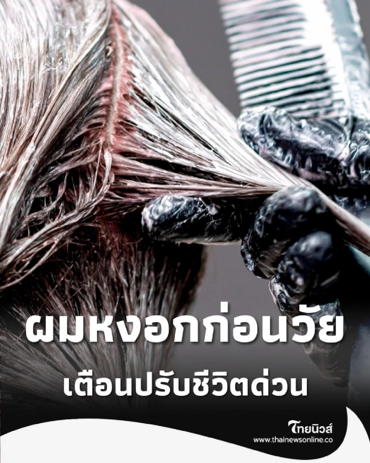 ผมหงอกก่อนวัย คือไฟเตือนสุขภาพที่แพทย์อยากให้คุณใส่ใจ