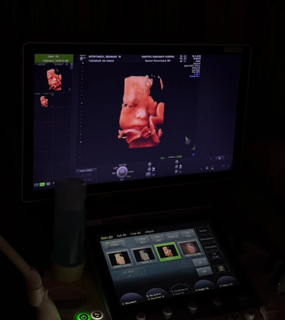 เจมส์ จิรายุ อวดโมเมนต์ โพสต์อัลตราซาวด์ 4 มิติ ลูกชายคนแรก