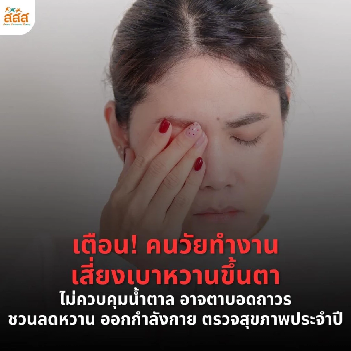 เตือน! วัยทำงานเสี่ยงเบาหวานขึ้นตา ชี้อาจนำไปสู่อาการตาบอดถาวร