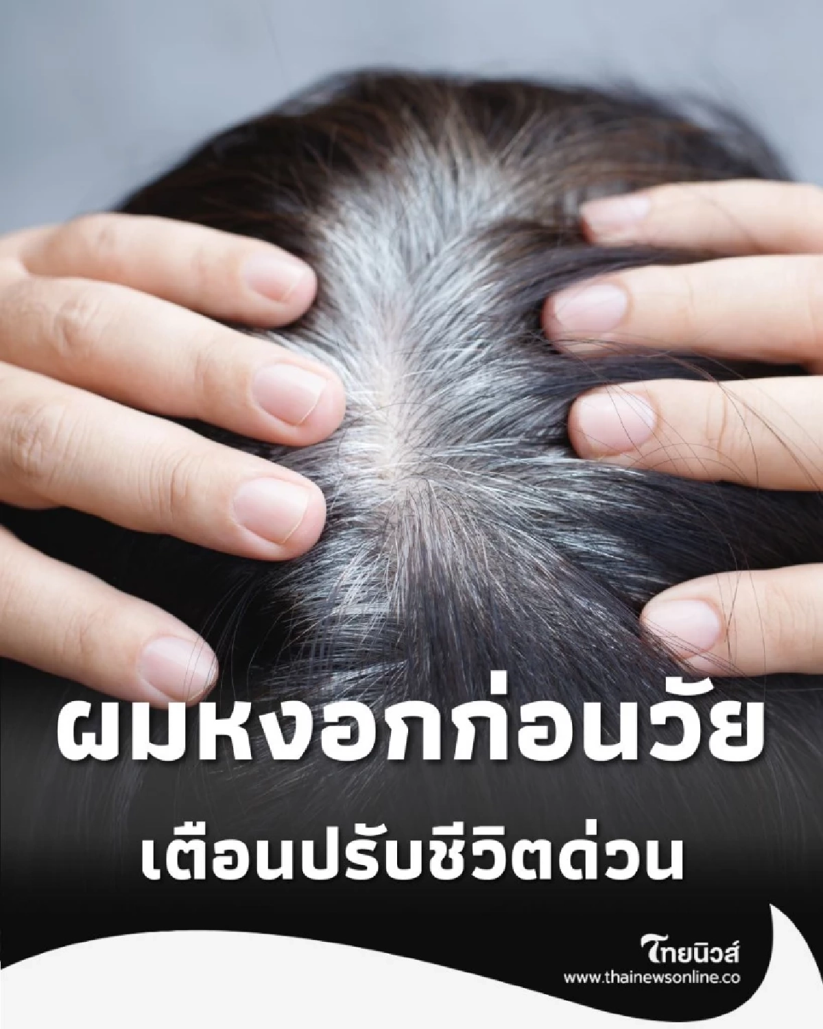 ผมหงอกก่อนวัย คือไฟเตือนสุขภาพที่แพทย์อยากให้คุณใส่ใจ