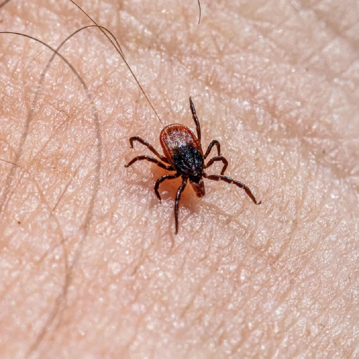 &quot;เตือนโรคติดเชื้อไวรัสจากเห็บสู่คน ระบาดหนักปีใน 68&quot;