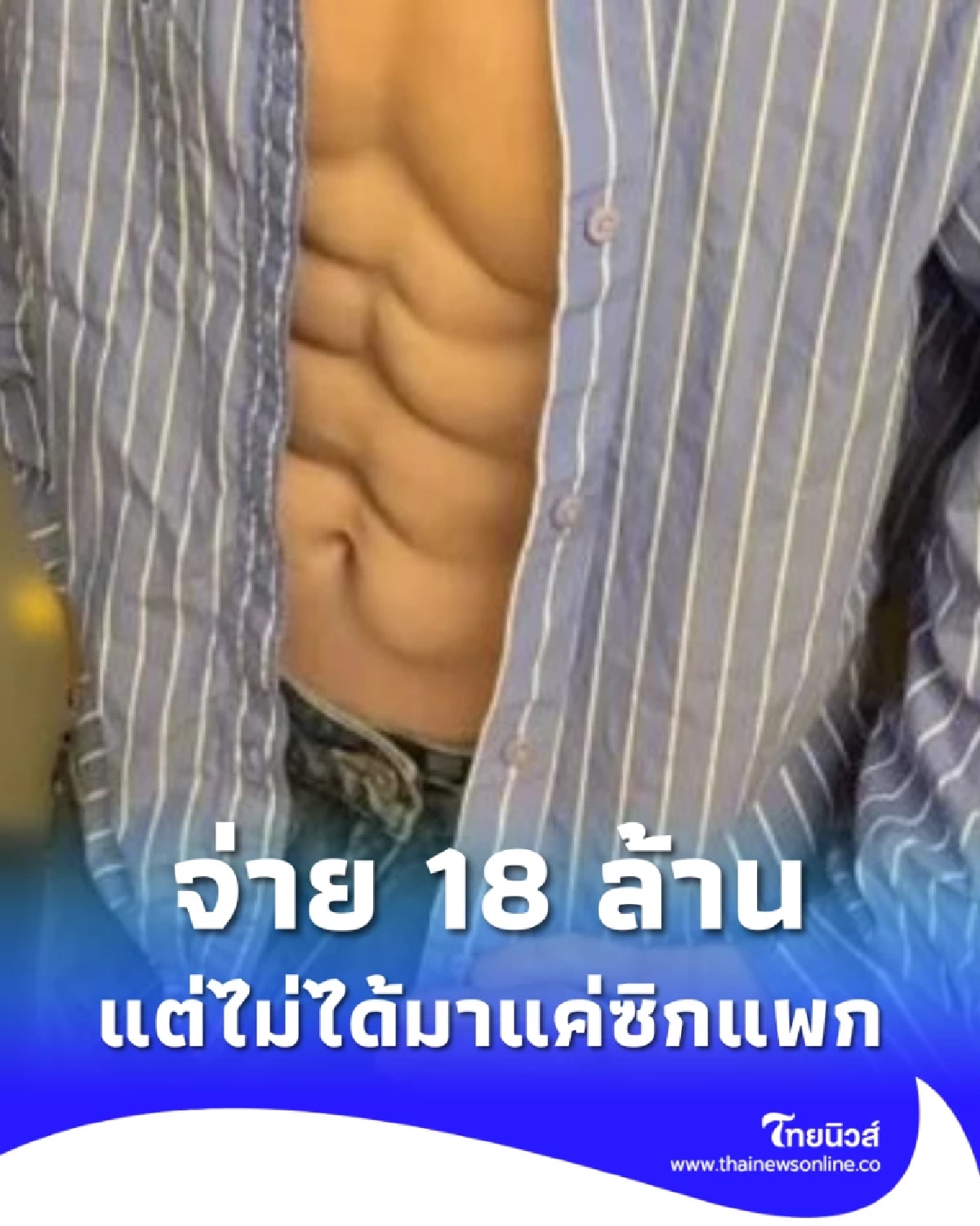 หนุ่มอยากมีกล้ามท้อง ตัดสินใจจ่าย 18 ล้าน  แต่ไม่ได้มาแค่ ซิกแพก