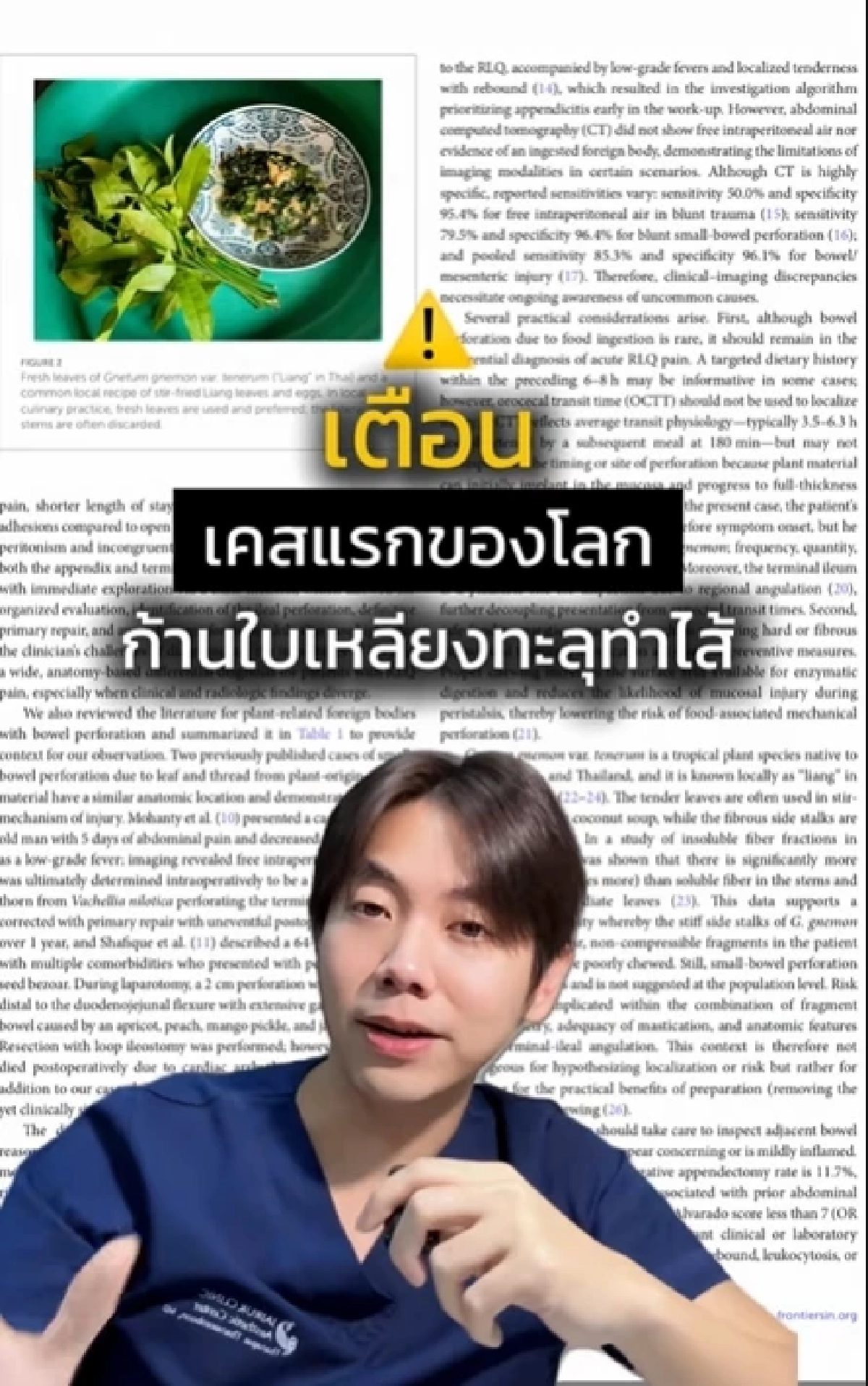 เคสแรกของโลก ชายปวดท้องหนัก ผ่าตัดเจอ สาเหตุเพราะก้านใบเหลียง