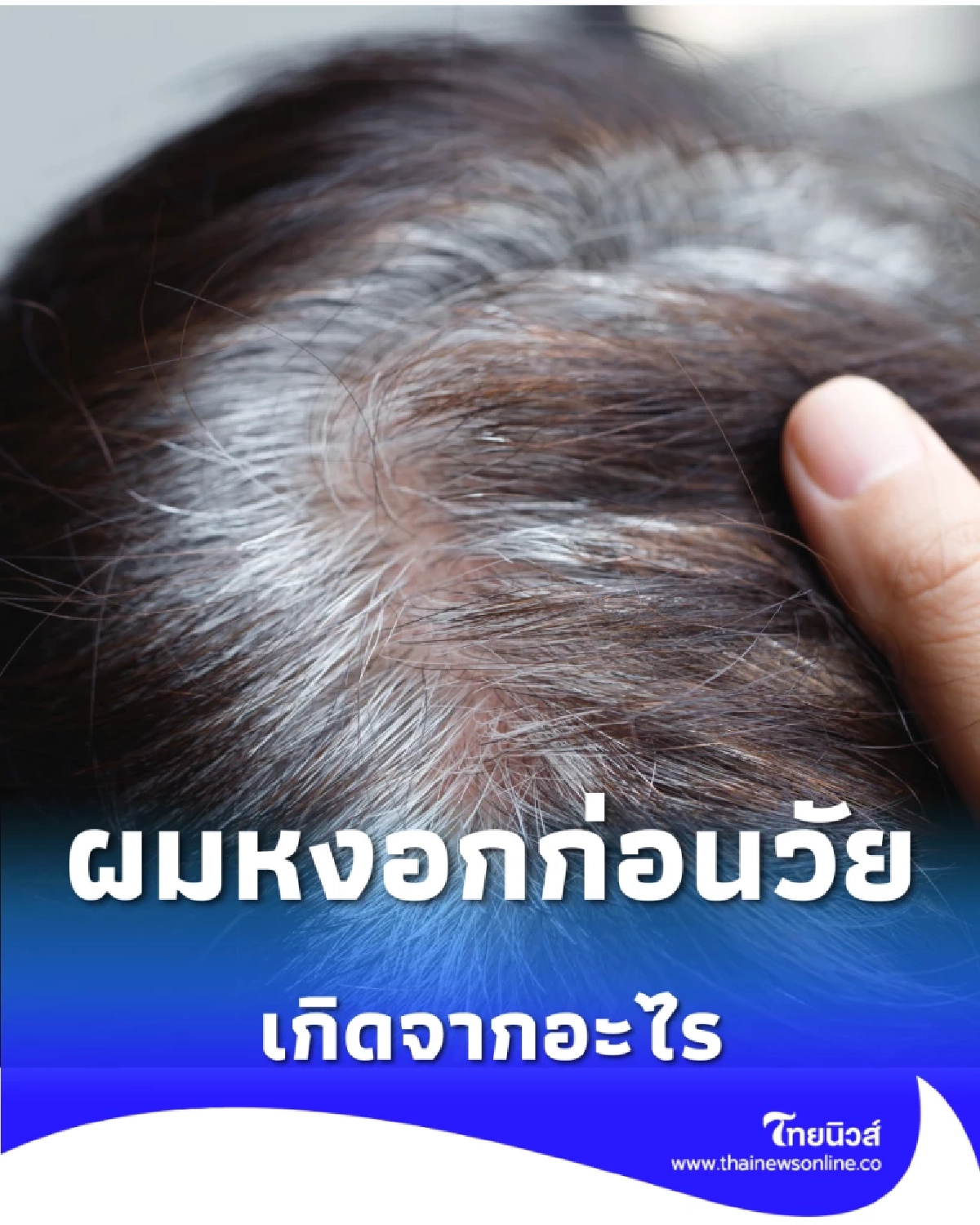 ผมหงอกก่อนวัยเกิดจากอะไร เช็ก 5 สาเหตุที่ทำให้ผมขาว ทั้งที่อายุน้อย