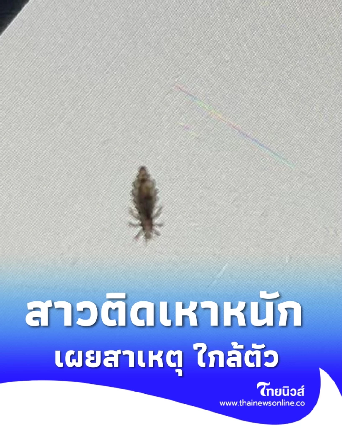 สาวคันหัว นึกว่าภูมิตก เจอความจริงชวนขนลุก สระผมบ่อยก็ไม่รอด