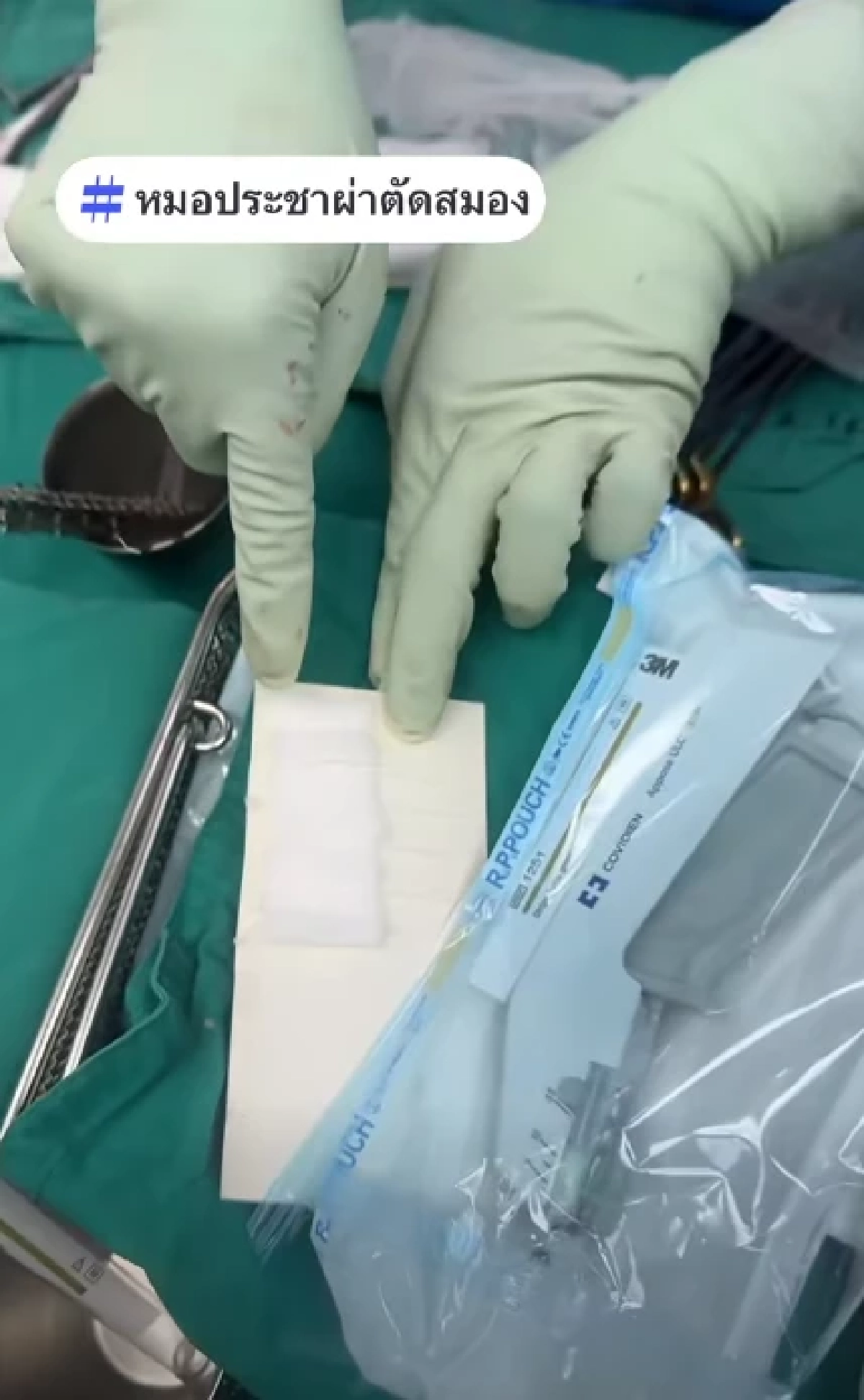 หมอประชาเล่าเคส เตือนภัยหน้าหนาว เสี่ยงทำเส้นเลือดในสมองแตก