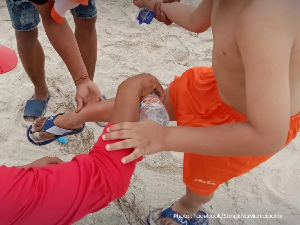 เทศบาลนครสงขลาเตือนแมงกะพรุนพิษบุกหาดสมิหลา
