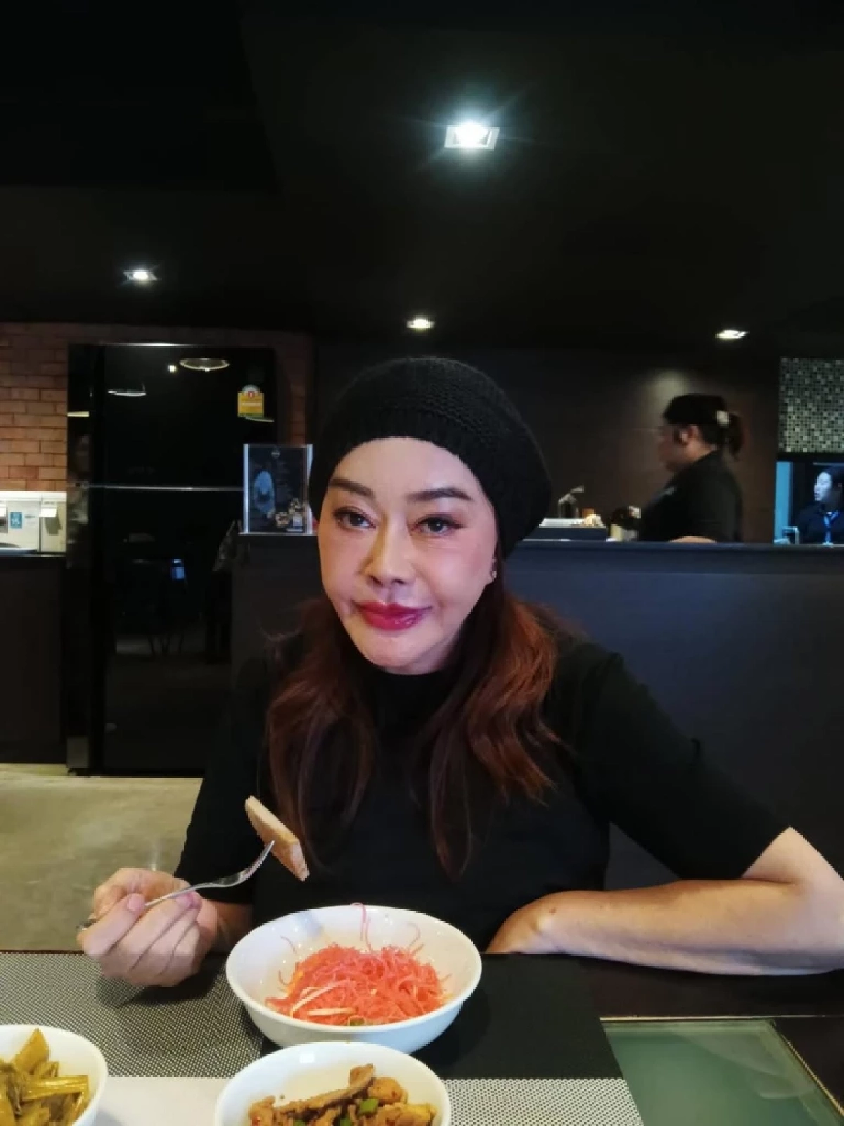 “จิ๊ก เนาวรัตน์” เปิดใจชีวิตพัง หลังทนพิษศัลยกรรมนาน 3 ปี