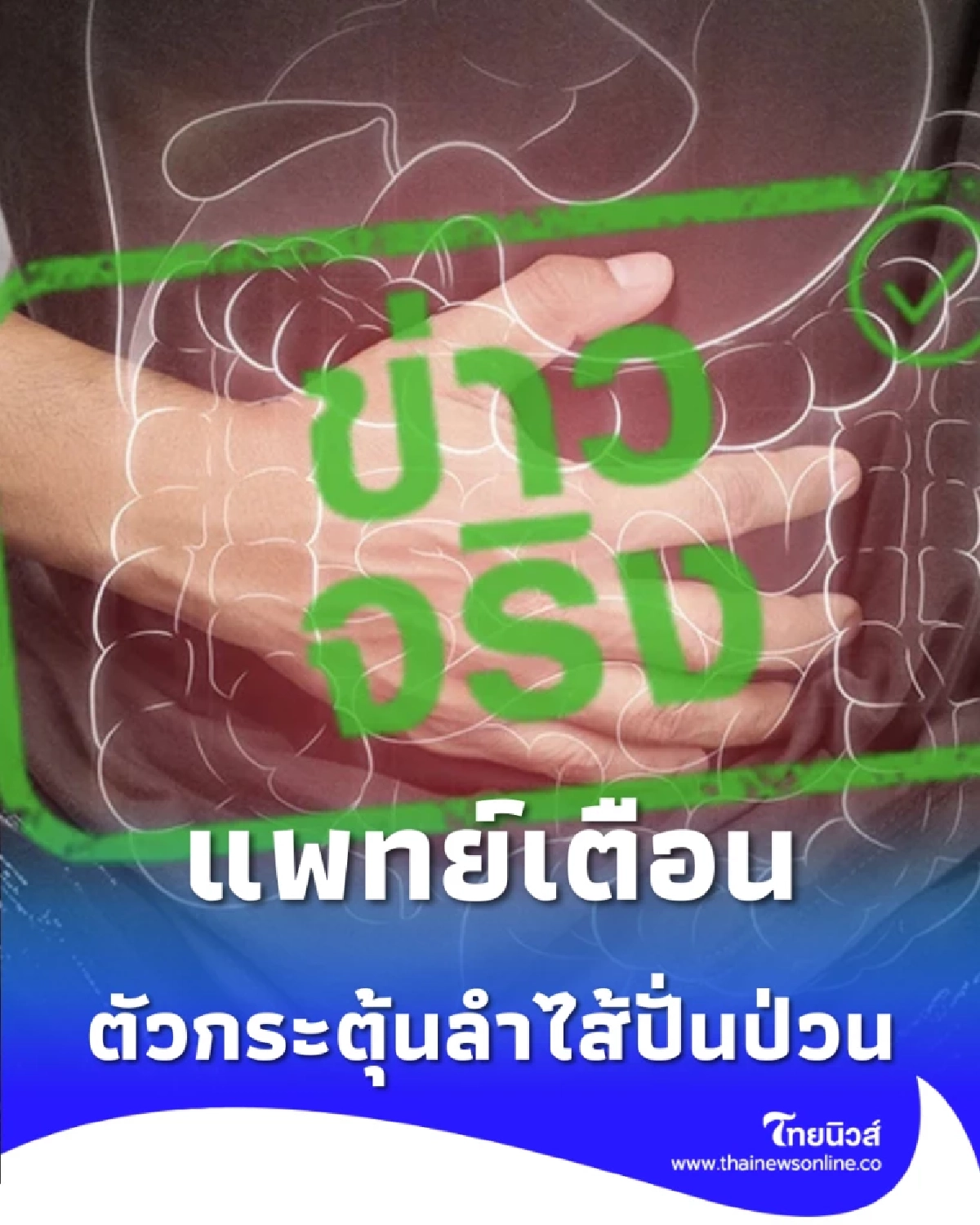 ระวัง แพทย์เตือน คาเฟอีน ตัวกระตุ้นลำไส้ปั่นป่วน ใครเป็นโรคนี้ต้องเลี่ยง