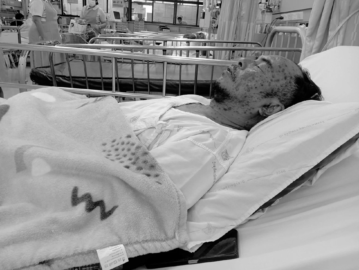 จิตอาสาจับงู ป่วยหนัก "นิค อสรพิษวิทยา" วอนช่วยหลังค่ารักษาพุ่ง