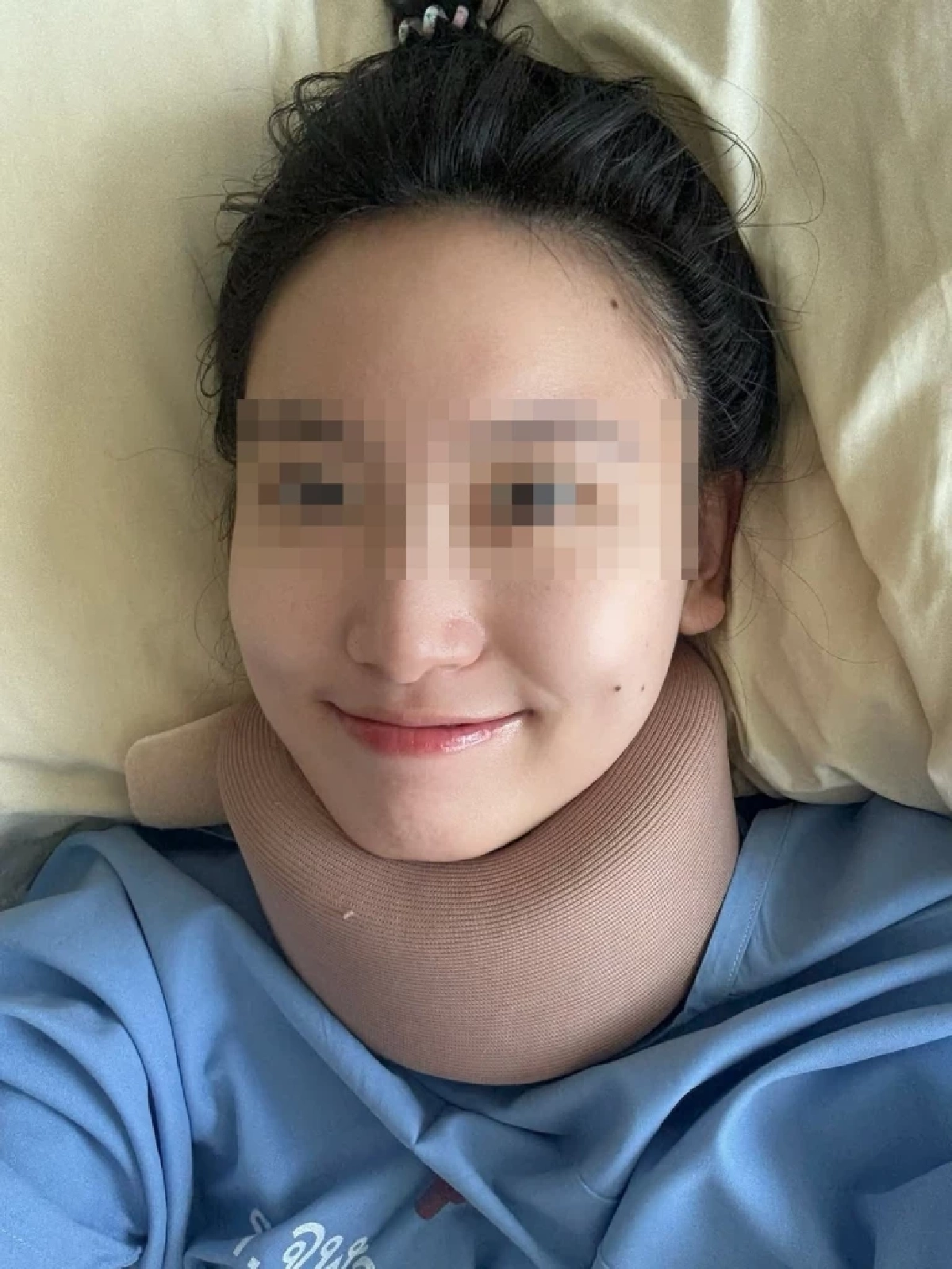 หมอสาว เล่านาทีชีวิต ไรเดอร์พาฝ่าไฟแดงชนสนั่น ร่างกระแทกแบริเออร์