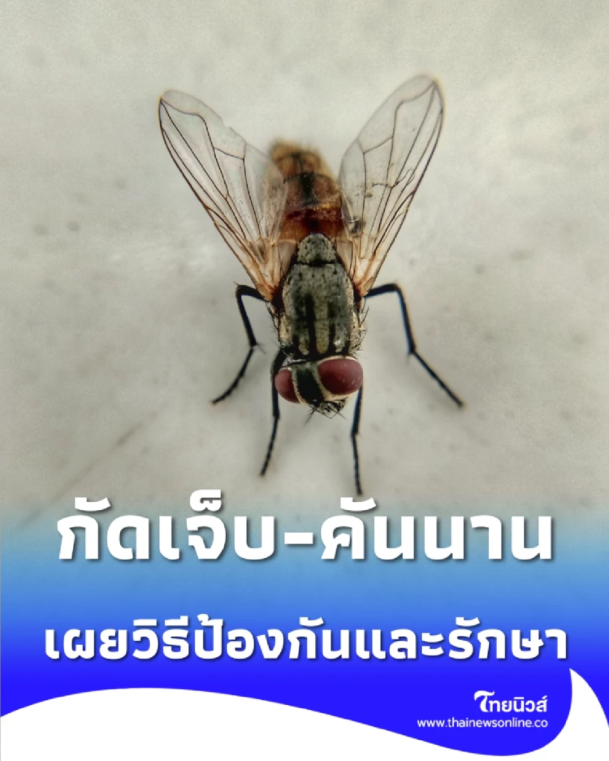 ระวัง ตัวคุ่น ภัยเงียบริมน้ำตก กัดเจ็บ-คันนาน เผยวิธีป้องกันและรักษา